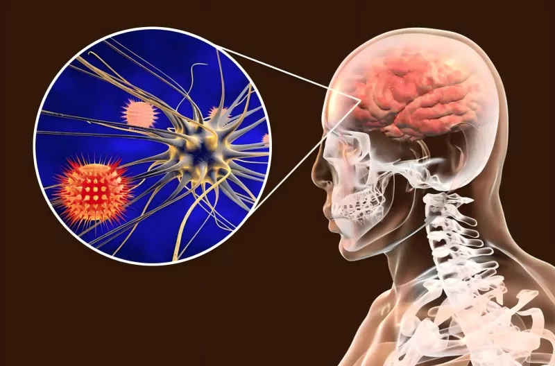 Meningokockvaccinguide Meningokockvaccinguide